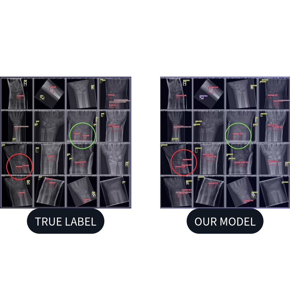 Model vs true values Xray